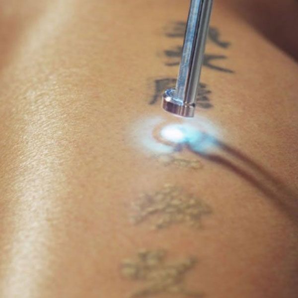 Nd Yag Piko laser